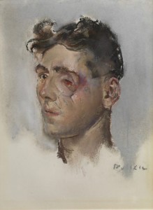 soldier_facial_wound