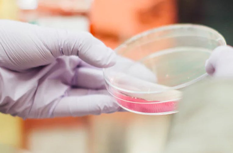 Hand Holding Lab Dish (c) unsplash