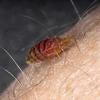 Bed Bugs
