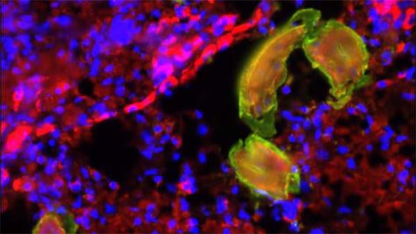 CIDVR parasitic worm (c) UCR SOM