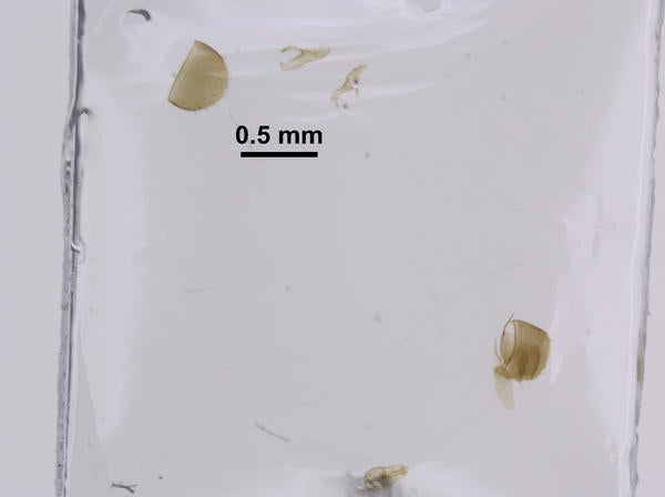 Adota colpophila Gusarov genitalia