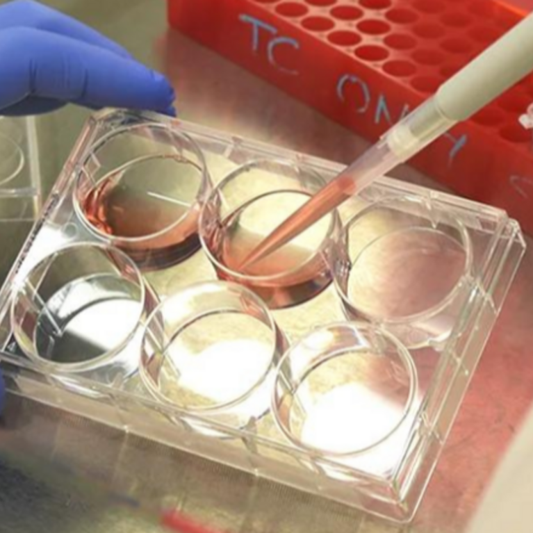 Gloved Hands Pipetting Samples in Laboratory Setting