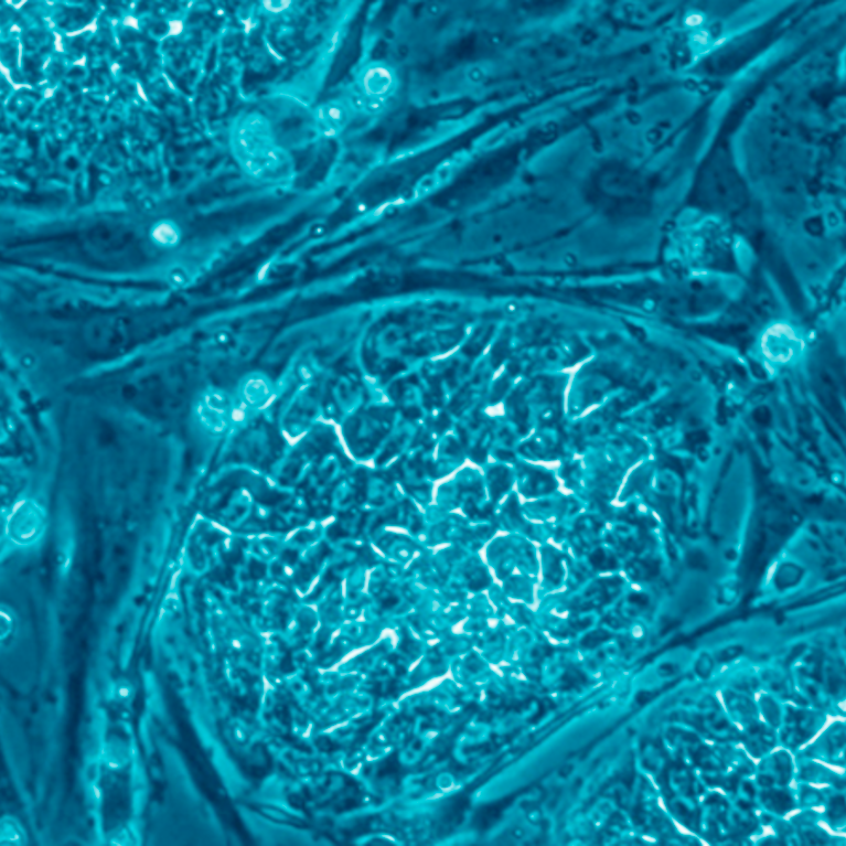 Human embryonic stem cells