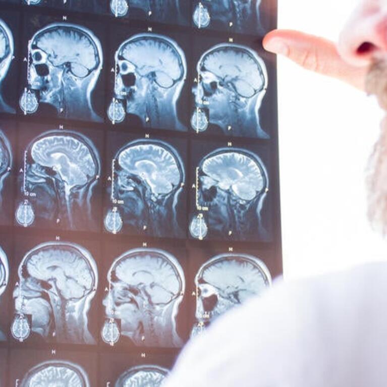 Image of medical personnel looking at a CT scan of a person's skull and brain