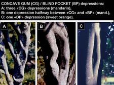 Concave Gum - Blind Pocket 