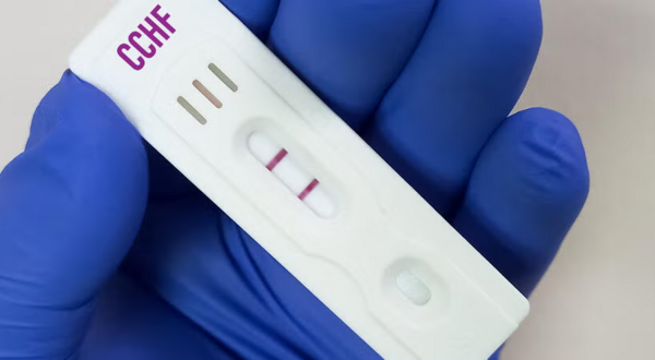 CCHFV test