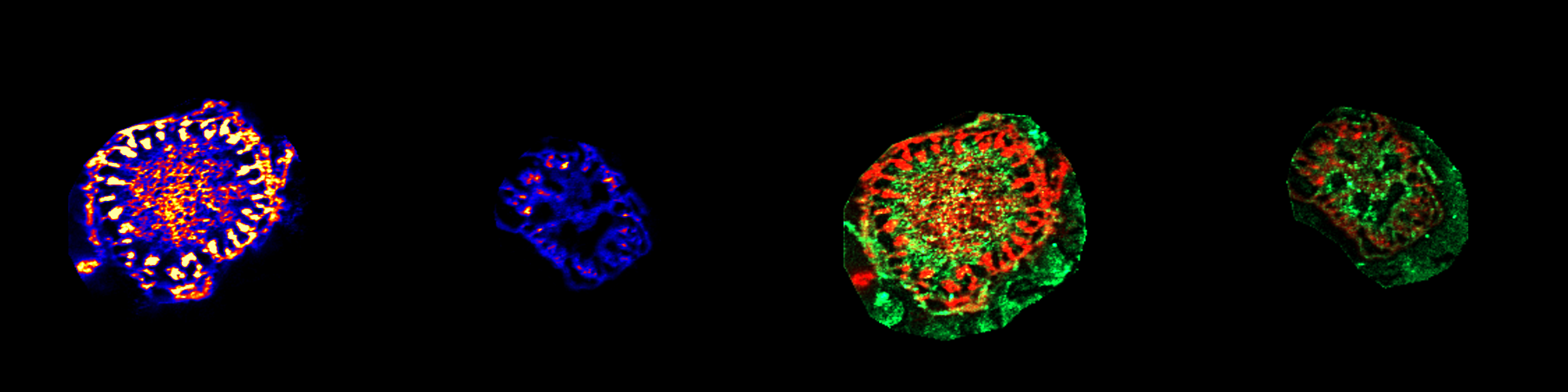 MS Imaging picture