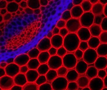 Extended Depth Multicolor Fluorescence Image