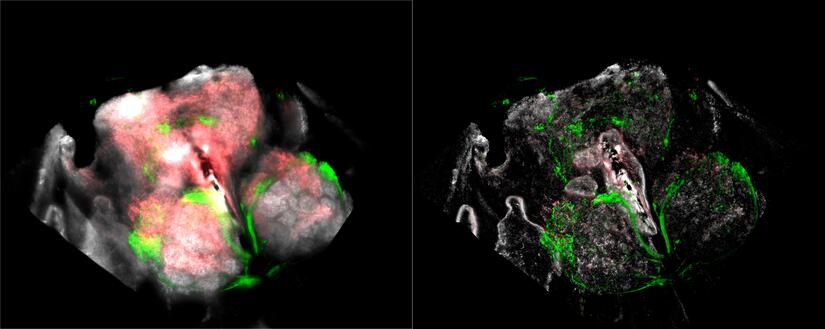 Thunder rendering of Drosophila brain Almost instant 3D renderings are possible with Leica Computational Clearing