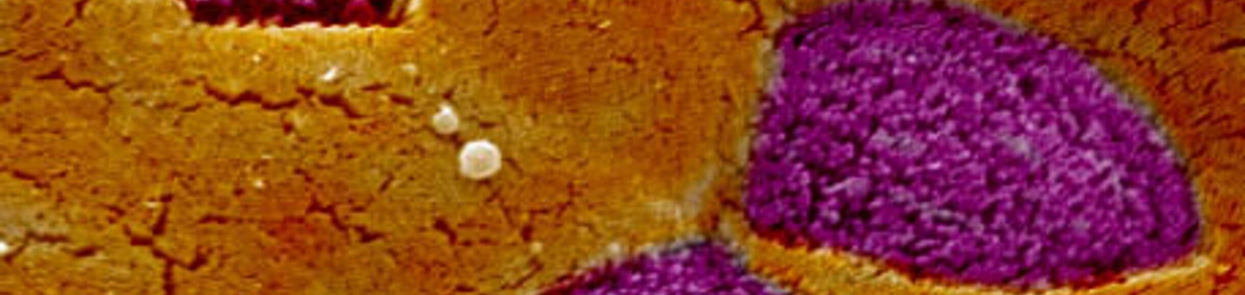 M cells and Mucosal Immune Surveillance