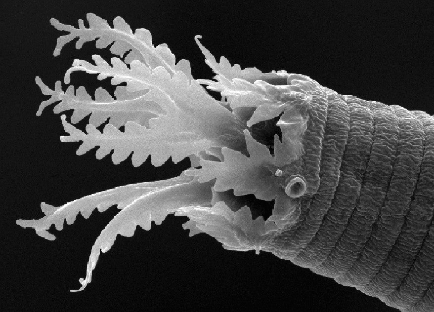 Scanning Electron Micrographs.