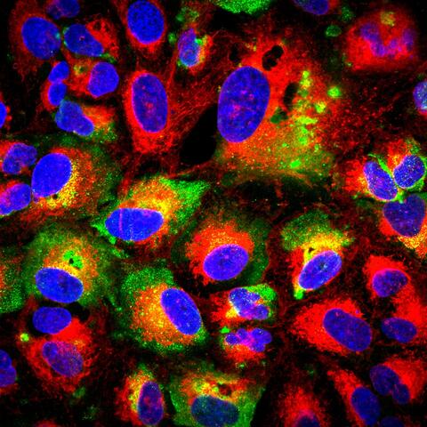 Surface expressed nucleocapsid protein on infected cells