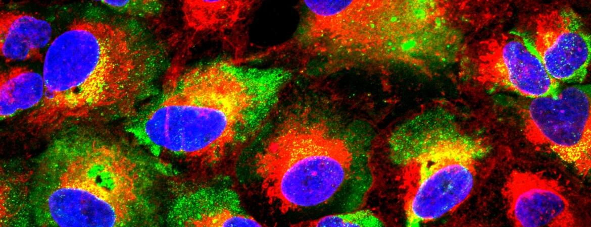 Surface expressed nucleocapsid protein on infected cells