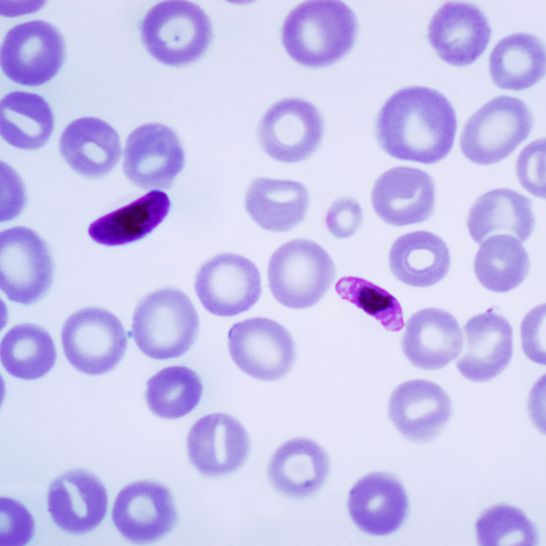 Plasmodium falciparum