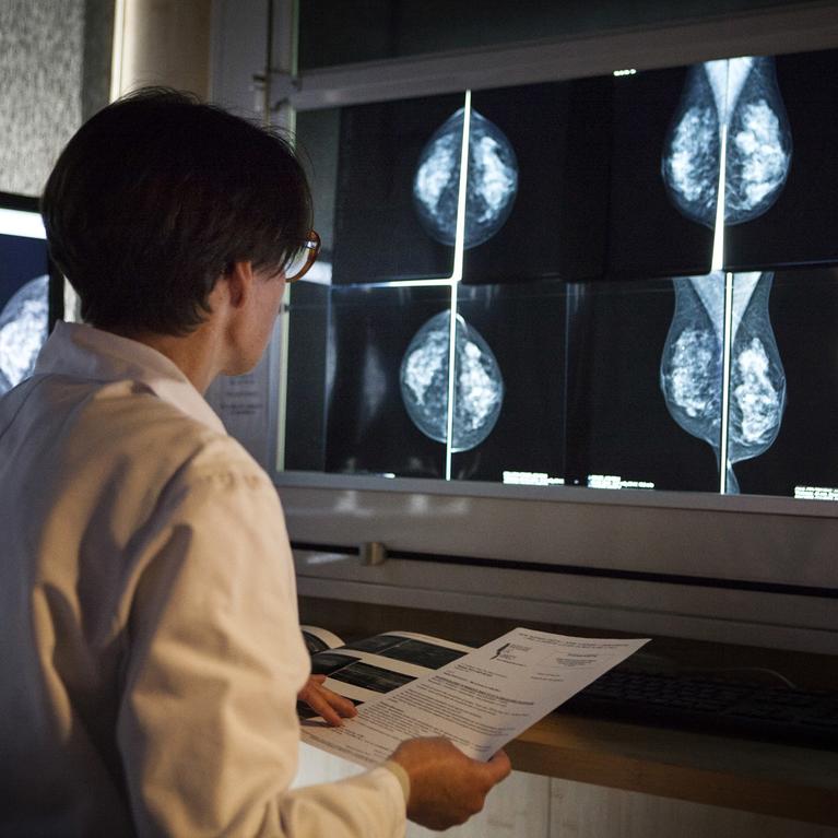 Asian women who immigrate to U.S. may have higher breast cancer risk, research finds