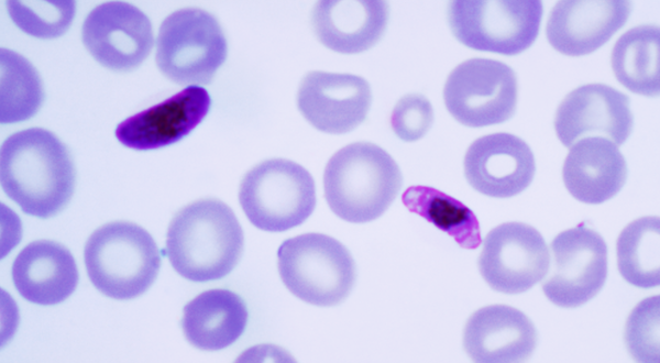 plasmodium falciparum