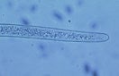 CISR sting_nematode_thumb