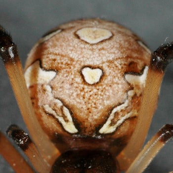 lat geom anterior abdomen (c) CISR