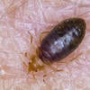 Bed Bugs
