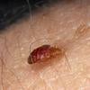 Bed Bugs