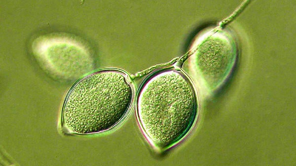Phytophthora (c) UCR