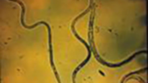 Nematodes (c) UCR
