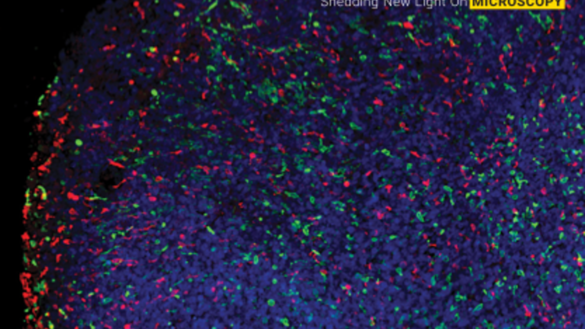 event flyer with fluorescent image