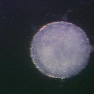 stem cell