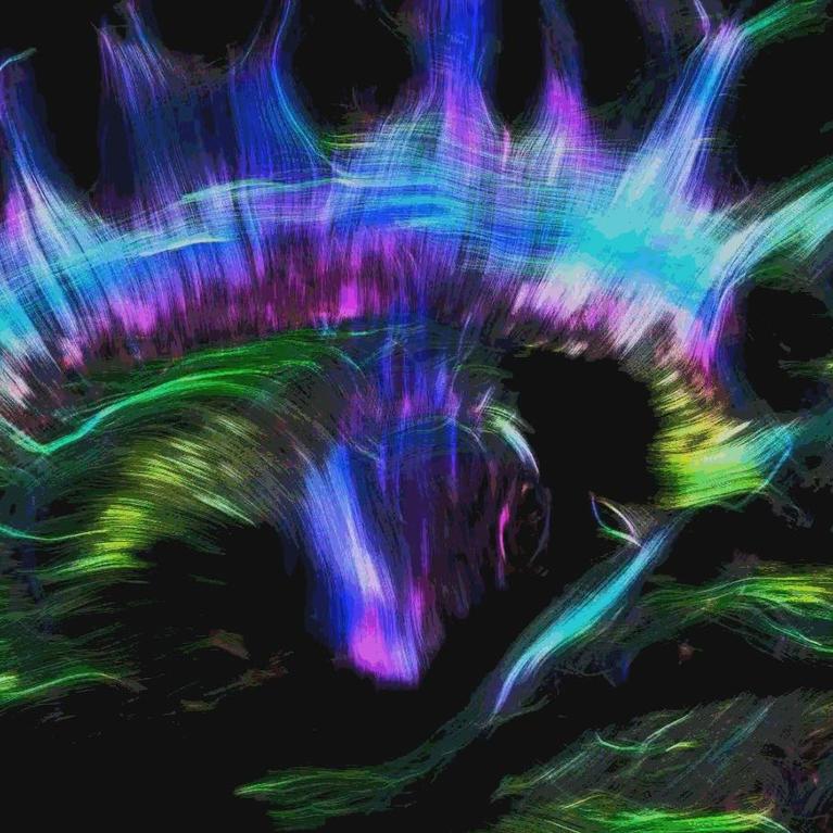 Diffusion tensor imaging Alfred Anwander CFCF