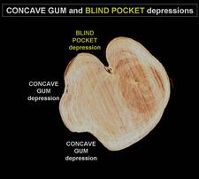 Concave Gum - Blind Pocket 