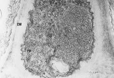 Vein Enation Woody Gall 