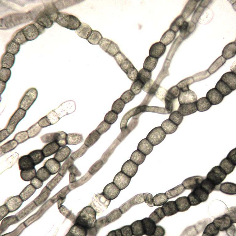 Coniosporium (c:stajichlab)