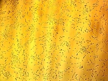 human epithelial lung cell