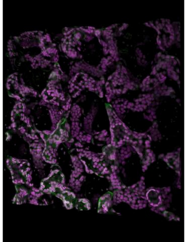 nanoparticles embedded in a plant cell