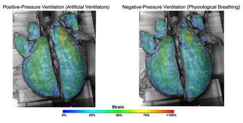 strain maps of lungs