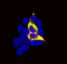 Zika and the immune system