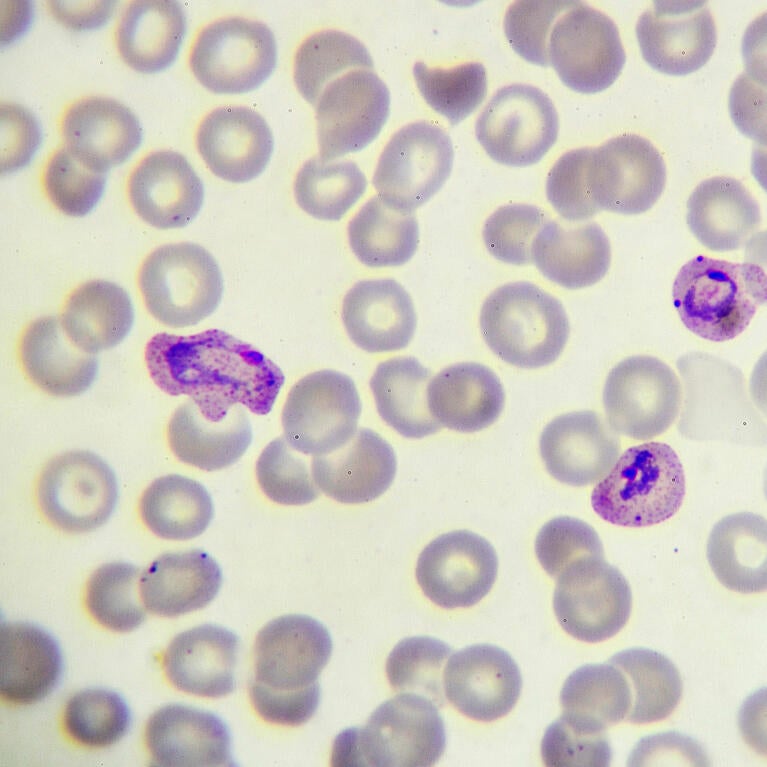 Malaria parasite in blood film