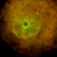 Enhanced photo shows algae has established a symbiotic relationship with coral without photosynthesis