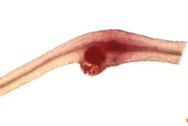 nematode releasing eggs