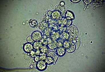 Bd fungal spores