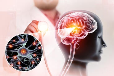 neurological research