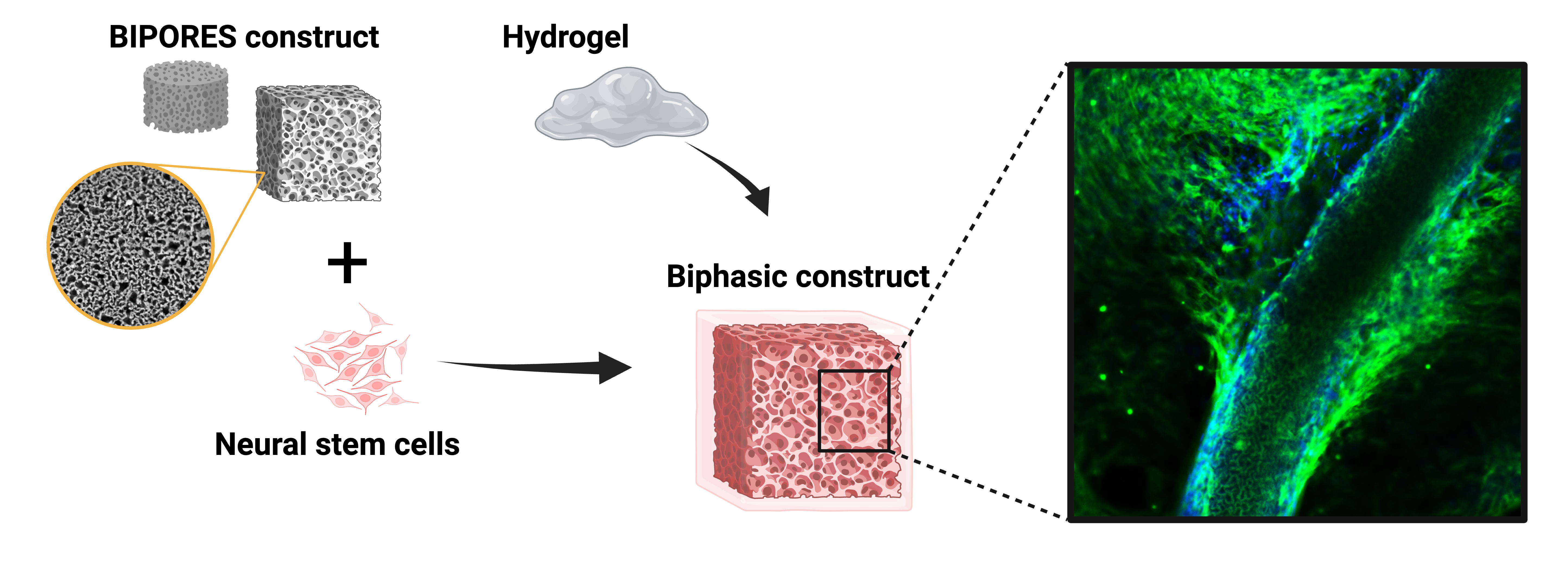 Neural Tissue Engineering