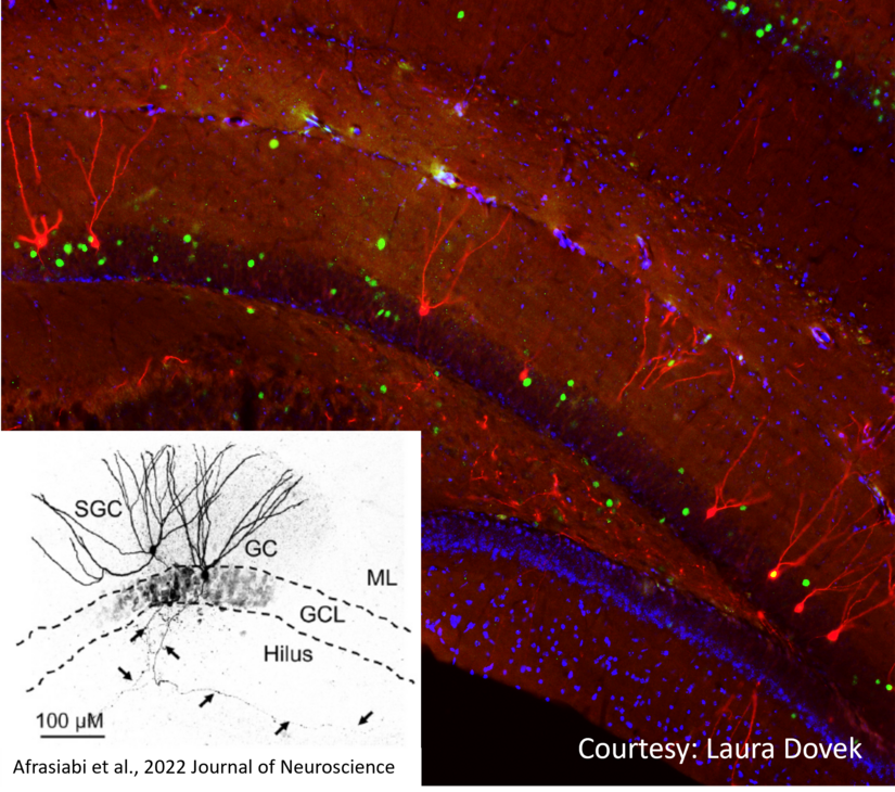 Santhakumar Lab Image