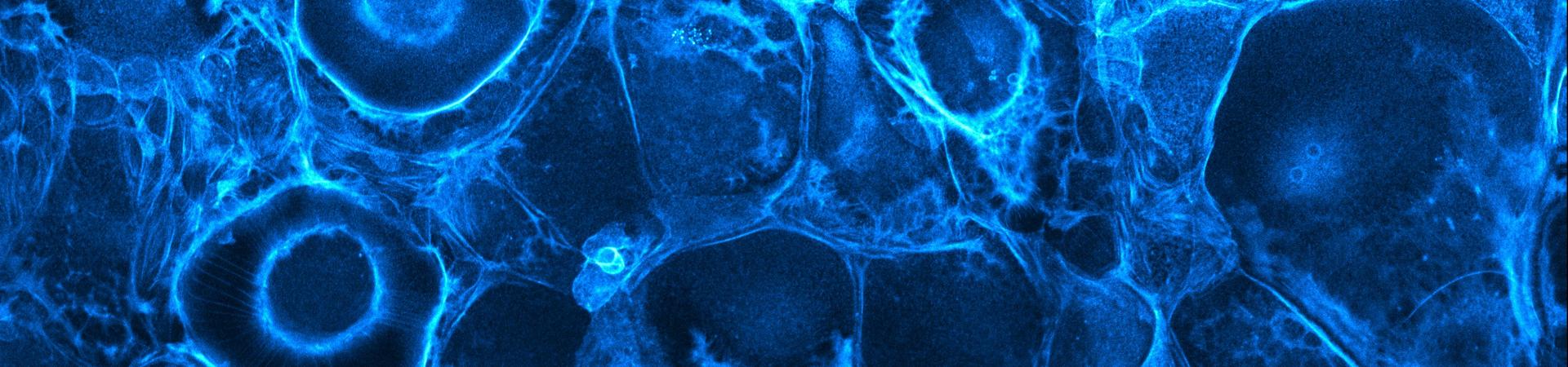 Pmergedcroppedcyanhot