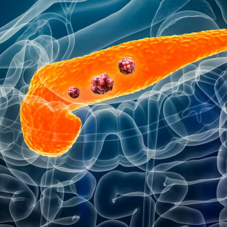 Pancreas (Getty Images)