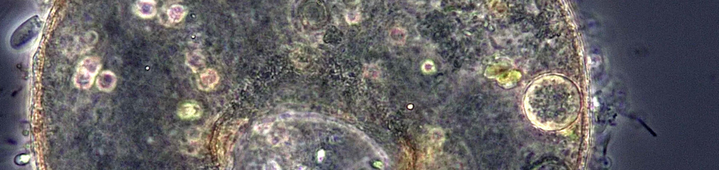 cell as seen under a microscope