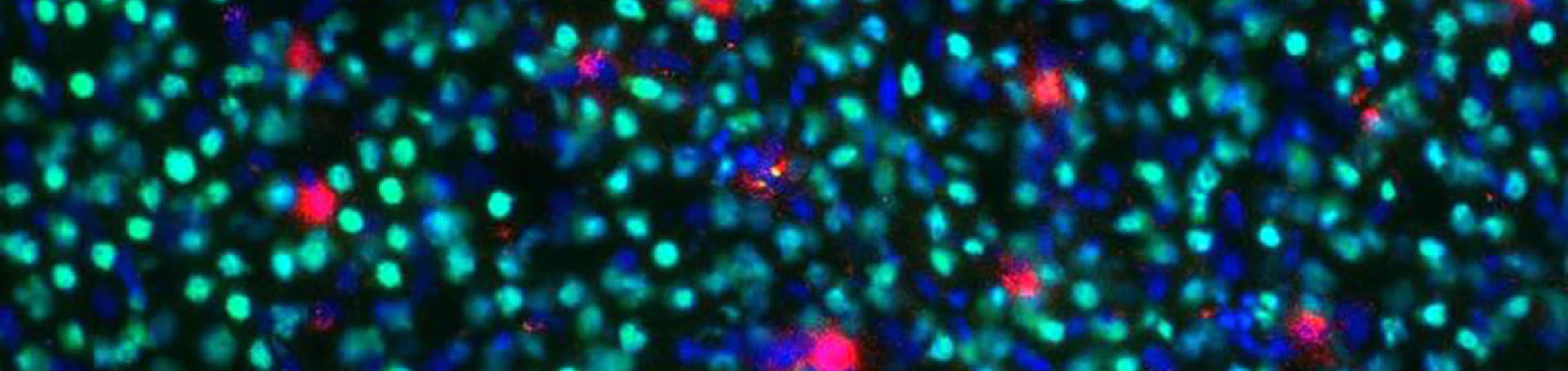 Anti-HNF4 alpha Antibody