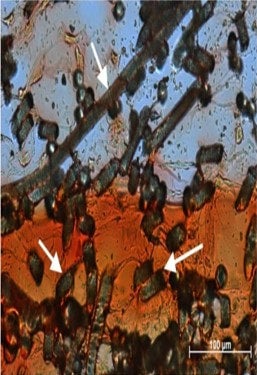 An engineered osteochondral interface with cartilage (top) and bone (bottom) phases