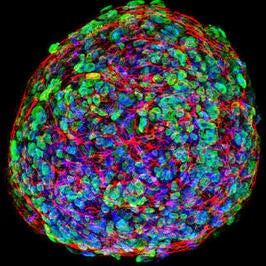 Confocal IF image of a 3D induced pluripotent stem cell colony on an electrospun scaffold