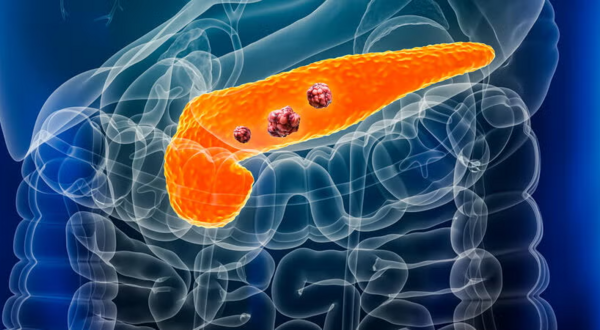 Pancreas (Getty Images)